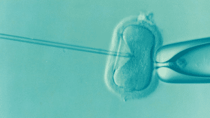 הפריה חוץ גופית IVF